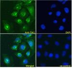 TIA-1 Antibody in Immunocytochemistry (ICC/IF)