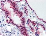 TIA-1 Antibody in Immunohistochemistry (Paraffin) (IHC (P))