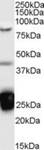 TIA-1 Antibody in Western Blot (WB)