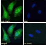 CK1 epsilon Antibody in Immunocytochemistry (ICC/IF)