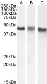 CK1 epsilon Antibody in Western Blot (WB)