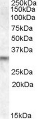 PRUNE2 Antibody in Western Blot (WB)