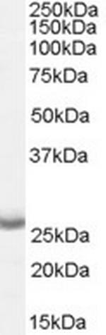 APH1 Antibody in Western Blot (WB)