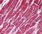 Fumarase Antibody in Immunohistochemistry (Paraffin) (IHC (P))