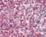 NCF4 Antibody in Immunohistochemistry (Paraffin) (IHC (P))