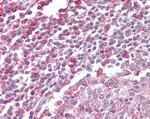 NCF4 Antibody in Immunohistochemistry (Paraffin) (IHC (P))