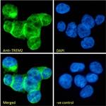 TREM2 Antibody in Immunocytochemistry (ICC/IF)