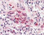 TREM2 Antibody in Immunohistochemistry (Paraffin) (IHC (P))