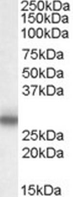 MPZ Antibody in Western Blot (WB)