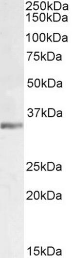 LDHC Antibody in Western Blot (WB)