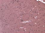 LGP2 Antibody in Immunohistochemistry (Paraffin) (IHC (P))