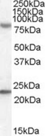 LGP2 Antibody in Western Blot (WB)