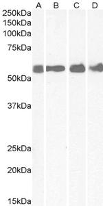 CRHR1 Antibody in Western Blot (WB)