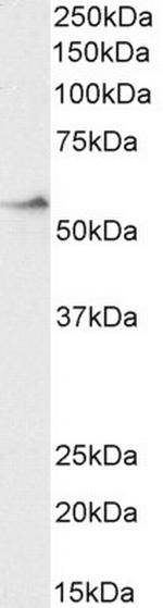 CRHR1 Antibody in Western Blot (WB)