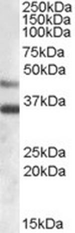 Arylsulfatase B Antibody in Western Blot (WB)