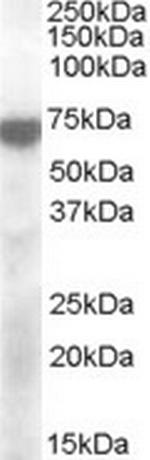 KCNQ4 Antibody in Western Blot (WB)