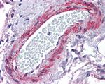 CRP2 Antibody in Immunohistochemistry (Paraffin) (IHC (P))