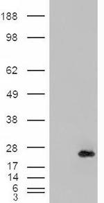 CRP2 Antibody in Western Blot (WB)