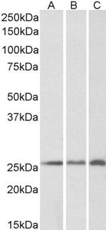 CRP2 Antibody in Western Blot (WB)