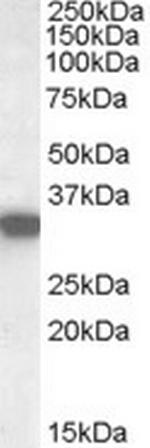 HADH Antibody in Western Blot (WB)