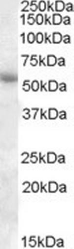 PTGER3 Antibody in Western Blot (WB)