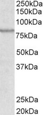 ABCB5 Antibody in Western Blot (WB)