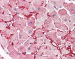 GOT1 Antibody in Immunohistochemistry (Paraffin) (IHC (P))