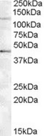 Tankyrase 2 Antibody in Western Blot (WB)