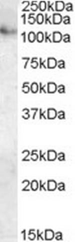 ATP13A1 Antibody in Western Blot (WB)