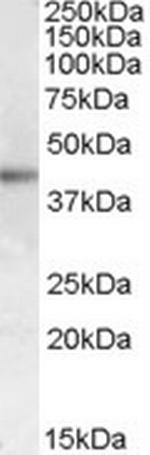 MC2R Antibody in Western Blot (WB)