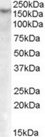 DNMT1 Antibody in Western Blot (WB)