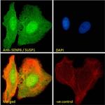 SENP6 Antibody in Immunocytochemistry (ICC/IF)