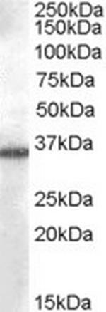 AKR1B10 Antibody in Western Blot (WB)