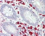 GCH1 Antibody in Immunohistochemistry (Paraffin) (IHC (P))