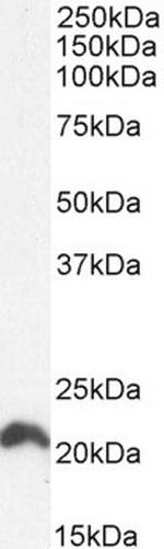 N-Ras Antibody in Western Blot (WB)