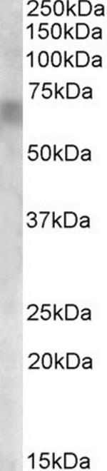 RPE65 Antibody in Western Blot (WB)