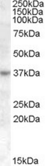 RASSF7 Antibody in Western Blot (WB)