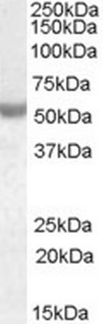 NOVA1 Antibody in Western Blot (WB)