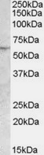 ATGL Antibody in Western Blot (WB)