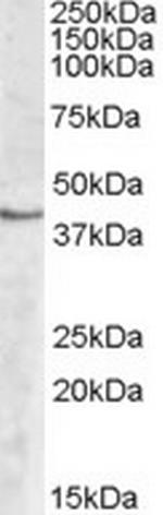 SPHK1 Antibody in Western Blot (WB)