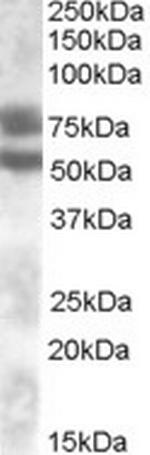 DACH1 Antibody in Western Blot (WB)