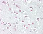 MC5R Antibody in Immunohistochemistry (Paraffin) (IHC (P))