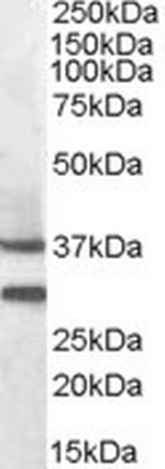 MC5R Antibody in Western Blot (WB)