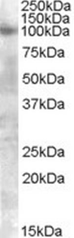 FGFR2 Antibody in Western Blot (WB)