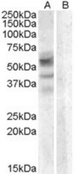 Arylsulfatase D Antibody in Western Blot (WB)