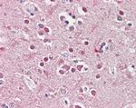 CHRNB2 Antibody in Immunohistochemistry (Paraffin) (IHC (P))