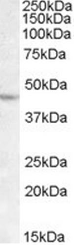 LHX2 Antibody in Western Blot (WB)