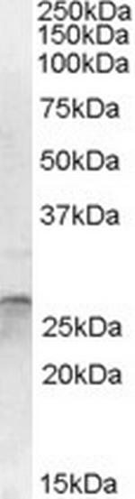 OTUB2 Antibody in Western Blot (WB)