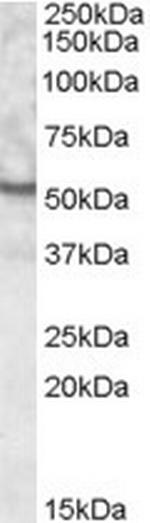 UNC5CL Antibody in Western Blot (WB)