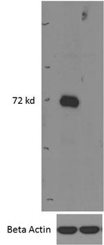 IRAK-M Antibody in Western Blot (WB)